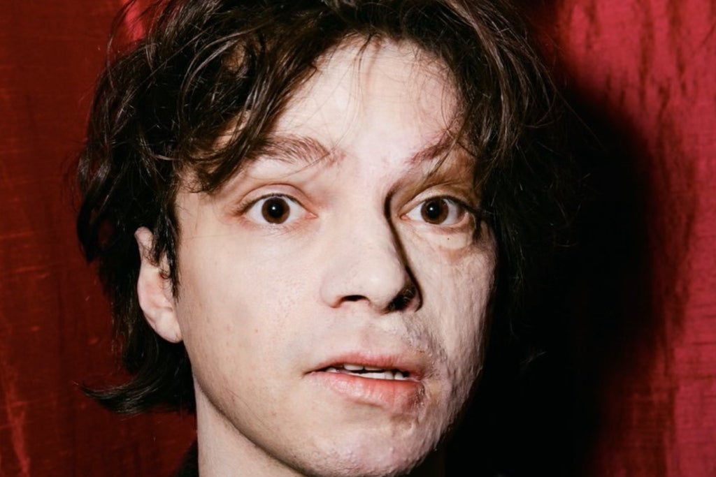 Keegan Tindall
